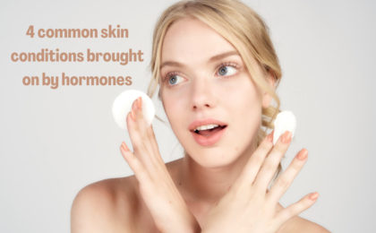 common skin conditions