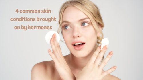common skin conditions